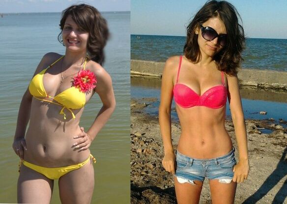 Anna perdeu 10 kg com NexaSlim
